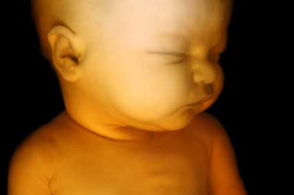 3d ultrasound baby image