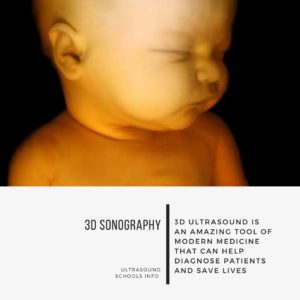 3D Sonography