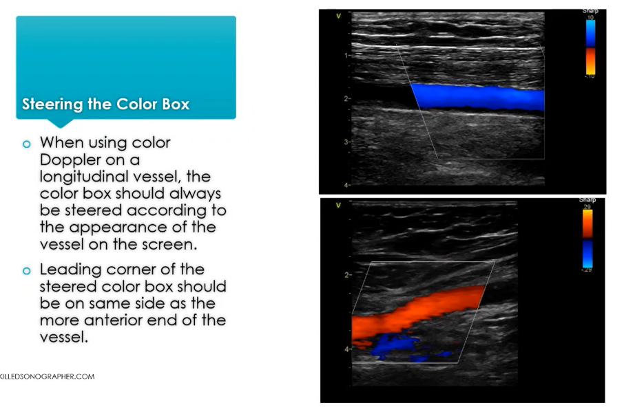 The Skilled Sonographer - Sample Study Screen